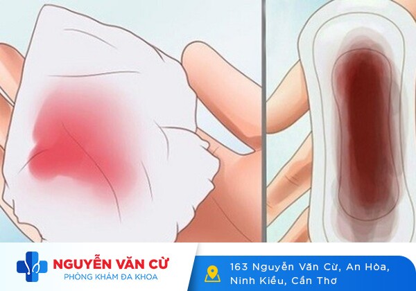 Phân biệt máu báo thai và máu kinh nguyệt