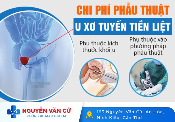 Chớ xem thường bệnh u xơ tuyến tiền liệt