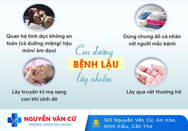 Bệnh lậu có lây không? – chồng mắc bệnh vợ có bị lây?