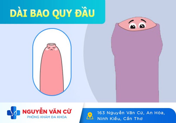 GIẢI ĐÁP: Dài Bao Quy Đầu Có Ảnh Hưởng Gì Không?