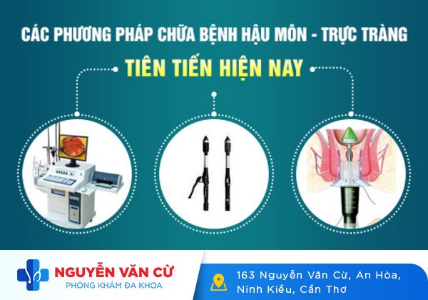Hậu Môn Ẩm Ướt Có Mùi Hôi Là Triệu Chứng Bệnh Gì?