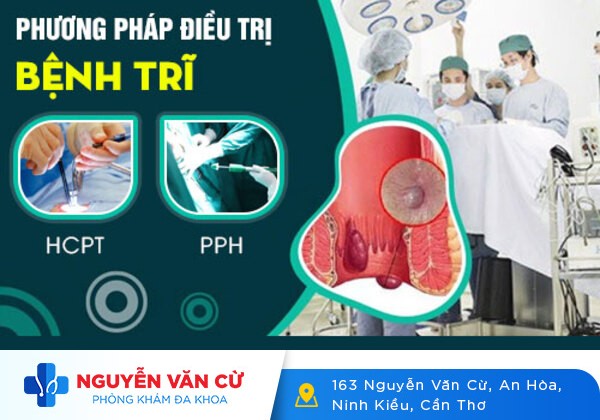 Chữa trĩ nội bằng phương pháp nào hiệu quả?