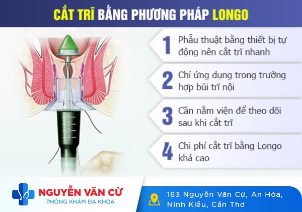 Cắt trĩ bằng phương pháp Longo có tốt không?