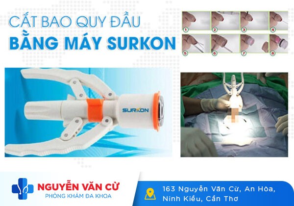Địa Chỉ Cắt Bao Quy Đầu Quận Ô Môn Uy Tín