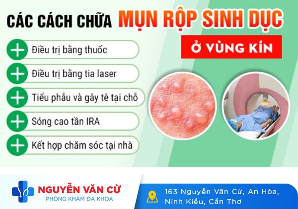 Những điều nữ giới nên biết về mụn rộp sinh dục nữ