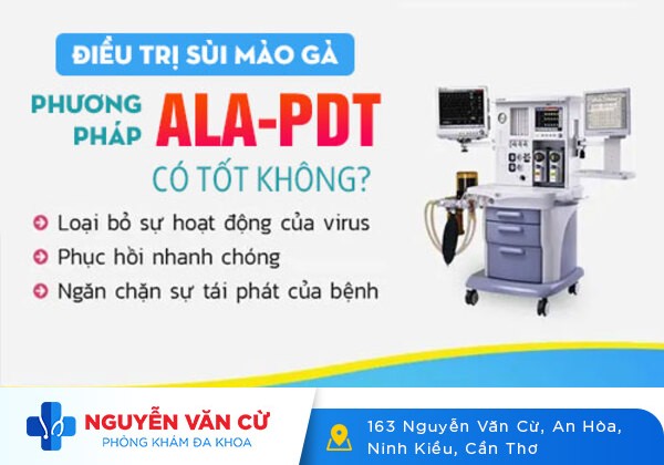 Nên Khám Bệnh Sùi Mào Gà Ở Đâu Tại Cần Thơ?