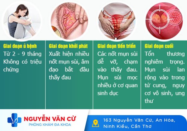 Triệu chứng bệnh sùi mào gà cụ thể nhất