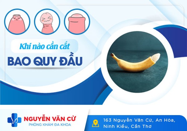 Cắt da bao quy đầu và những thông tin cần biết