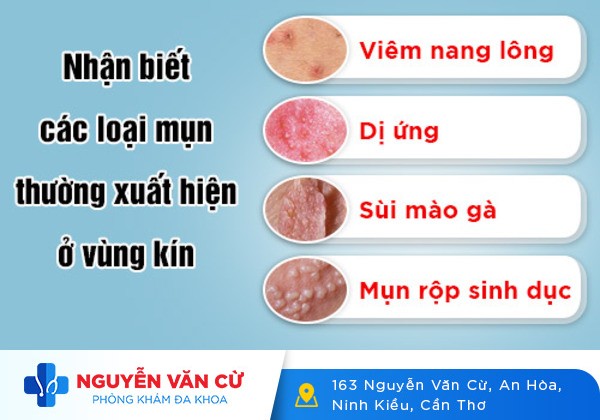 Nổi Mụn Vùng Kín Khám, Điều Trị Nhanh Trong Ngày