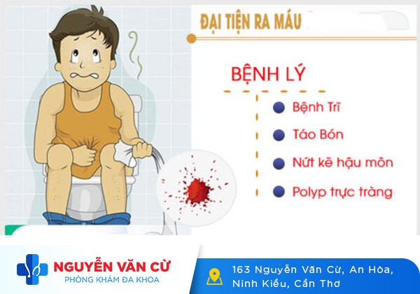 Đi cầu ra máu là dấu hiệu bệnh gì?