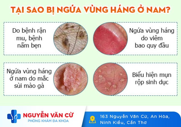 Đừng chủ quan khi bị ngứa bộ phận sinh dục nam, nữ