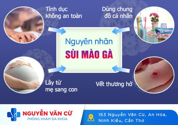 Sùi mào gà nữ và những điều cần biết