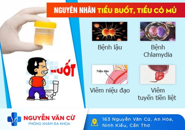 Đi Tiểu Buốt Có Mủ Ở Nam Và Nữ Là Dấu Hiệu Của Bệnh Nguy Hiểm Gì?