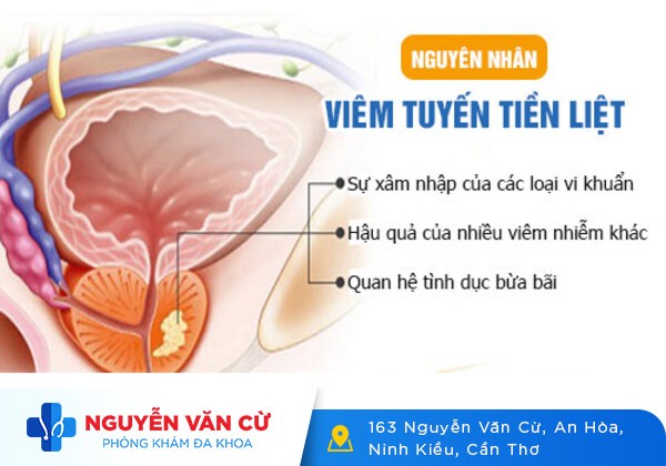Triệu Chứng Và Phương Pháp Điều Trị Viêm Tuyến Tiền Liệt