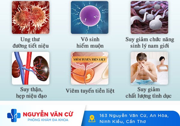 Ngứa lỗ tiểu, ngứa ống dẫn đường tiểu ở nam