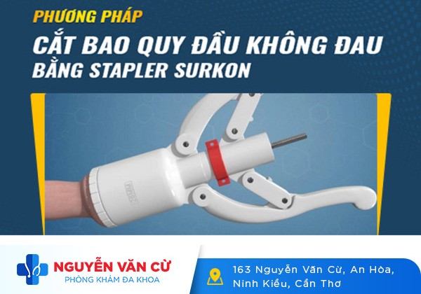 Địa Chỉ Cắt Bao Quy Đầu Huyện Vĩnh Thạnh Uy Tín Hiện Nay
