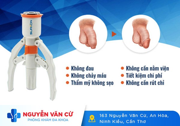 Cắt Bao Quy Đầu Đồng Tháp