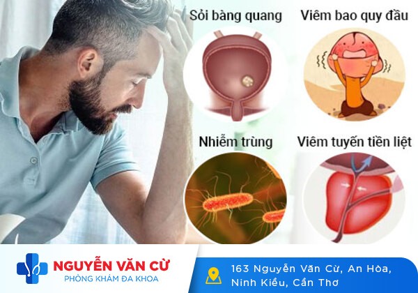Đau Nhức Dương Vật Khiến Nam Giới Phải Dè Chừng