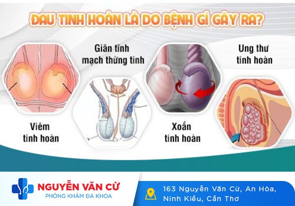 Chữa Đau Tinh Hoàn Tại Đa Khoa Nguyễn Văn Cừ