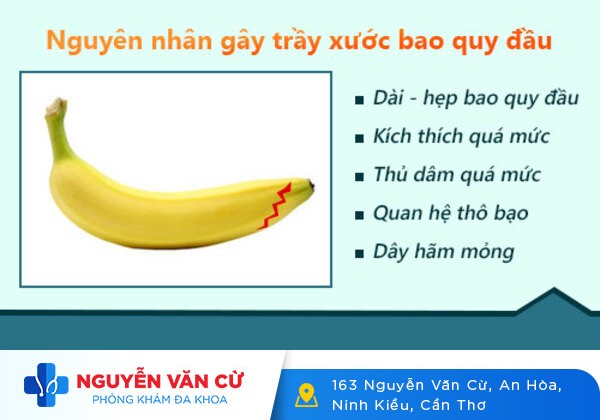 Hình ảnh trầy xước bao quy đầu cần biết