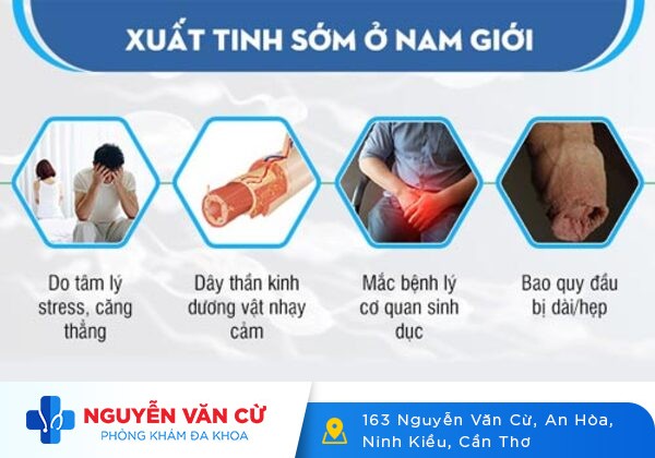 Quan hệ mau xuất tinh nỗi ác mộng của nam giới