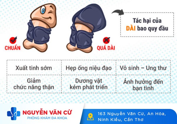 Dài bao quy đầu và những điều nam giới cần phải biết