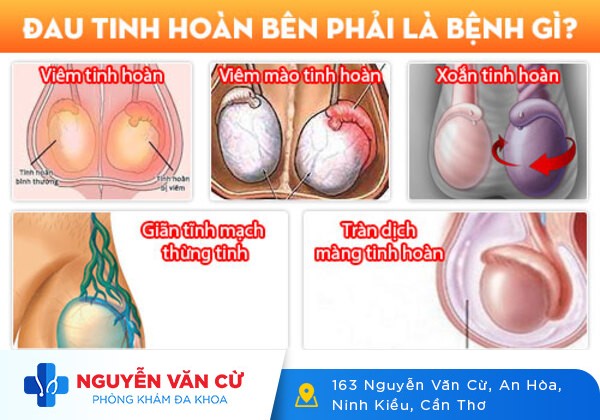 Đau Một Bên Tinh Hoàn: Nguyên Nhân Và Cách Điều Trị
