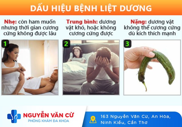 Dấu Hiệu Liệt Dương Qua Các Mức Độ Dễ Nhận Thấy Nhất