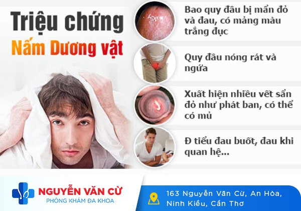 Bệnh Nấm Dương Vật Là Gì?