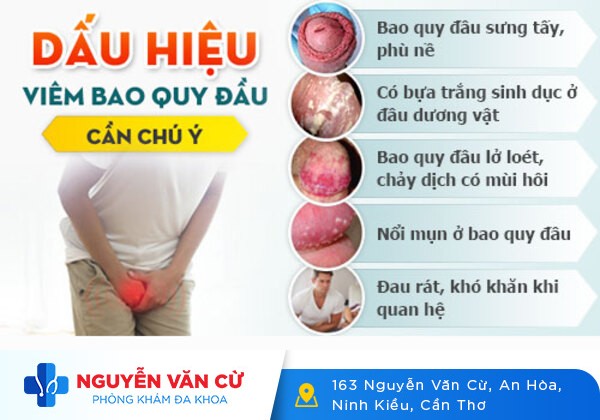 Viêm bao quy đầu nguy hiểm như thế nào?