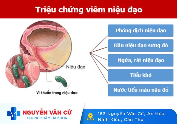 Nguyên nhân tiểu khó, đi tiểu khó ở nam nữ