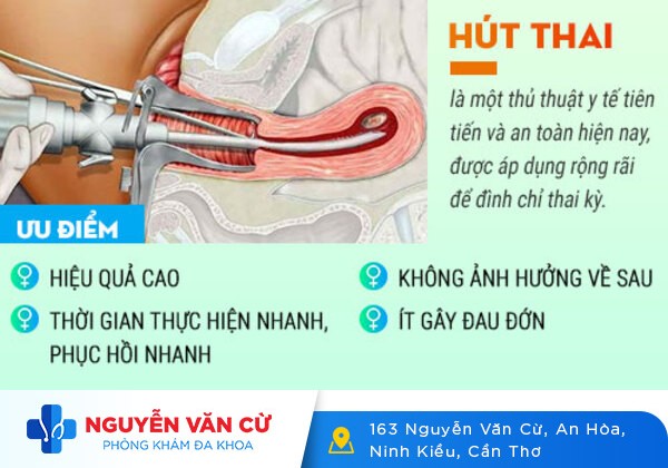 Các phương pháp bỏ thai an toàn được áp dụng hiện nay
