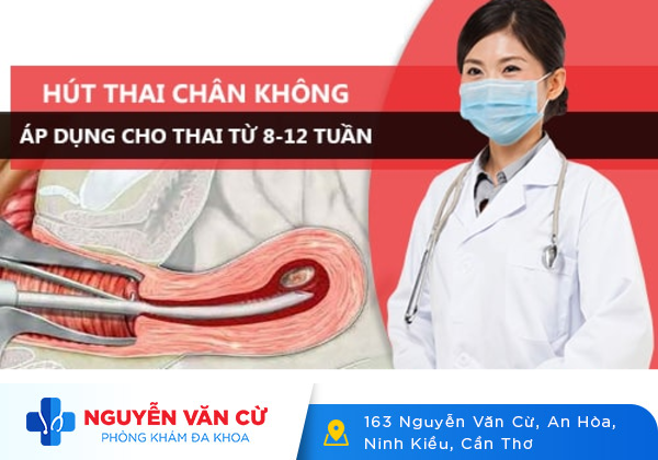 Phá thai theo tháng an toàn bằng những phương pháp nào?