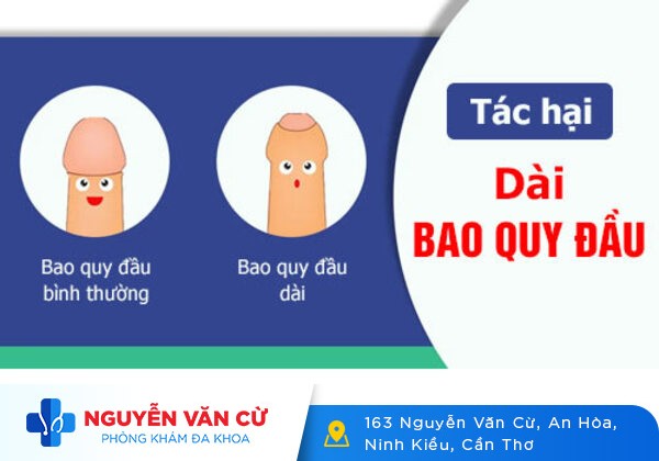 Dài bao quy đầu có nên cắt không?