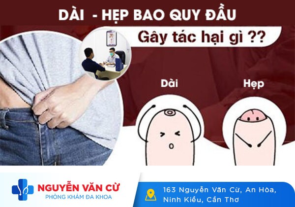 Dài Và Hẹp Bao Quy Đầu Có Ảnh Hưởng Gì Không?