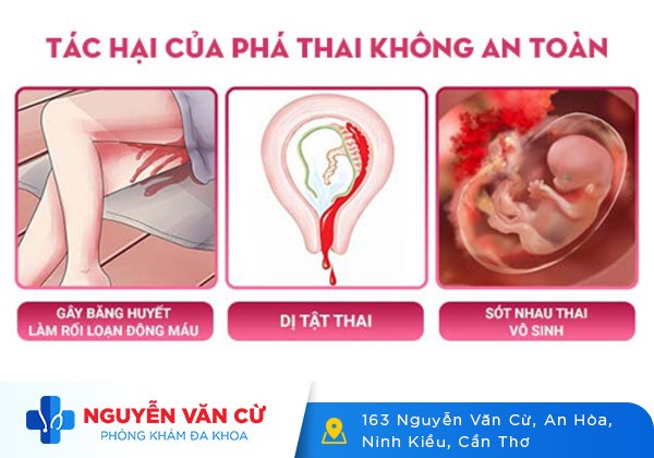 Địa chỉ phòng khám phá thai an toàn, bảo mật