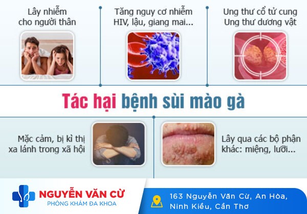 Chữa HPV Bằng Thuốc Có Hiệu Qủa? Phương Pháp Điều Trị HPV Tốt Nhất