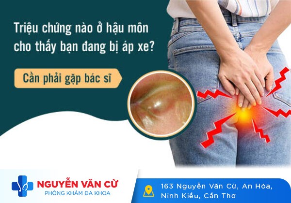 Hậu Môn Chảy Mủ Là Triệu Chứng Của Bệnh Gì?