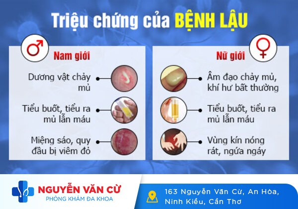 Phân Biệt Bệnh Lậu Và Bệnh Giang Mai