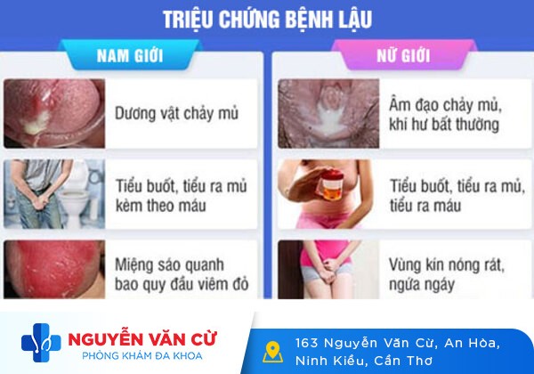 Các bệnh lây qua đường tình dục thường gặp