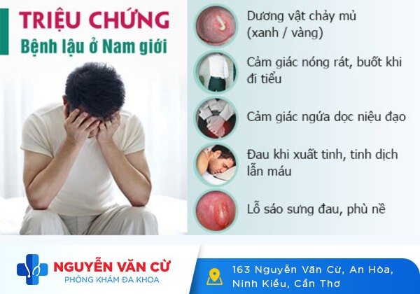 Bệnh lậu nam có thể gây vô sinh và nguy cơ tử vong cao