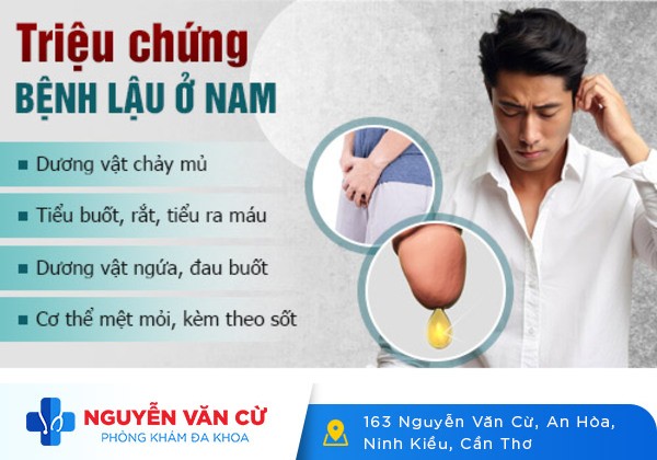Phương pháp hỗ trợ điều trị bệnh lậu ở nam hiệu quả