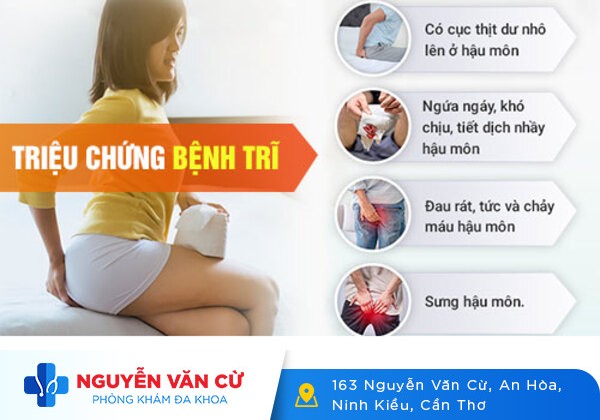 Địa chỉ điều trị bệnh trĩ uy tín