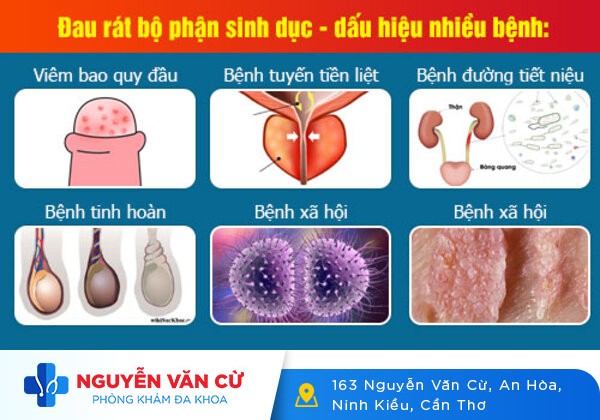 Đau dương vật là dấu hiệu bệnh nguy hiểm gì?