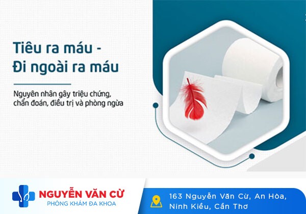 Đi Ngoài Ra Máu Tưởng Là Triệu Chứng Bình Thường Hóa Ra Là Bệnh Lý Nguy Hiểm