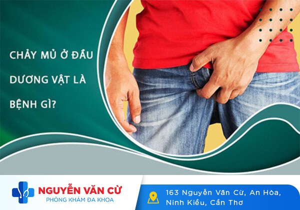 Dấu hiệu chảy dịch đầu dương vật và các bệnh lý liên quan
