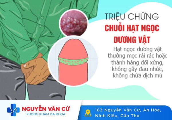 Tất cả những thông tin liên quan đến chuỗi hạt ngọc dương vật