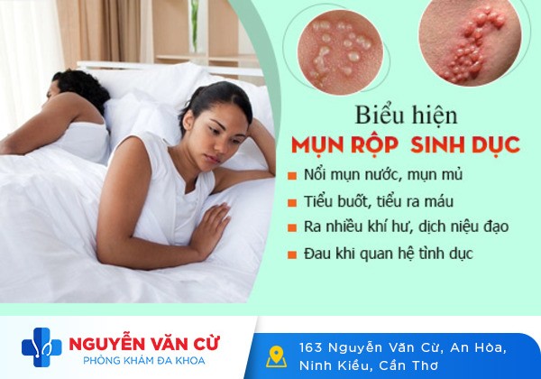 Mụn rộp sinh dục và những điều cần phải biết