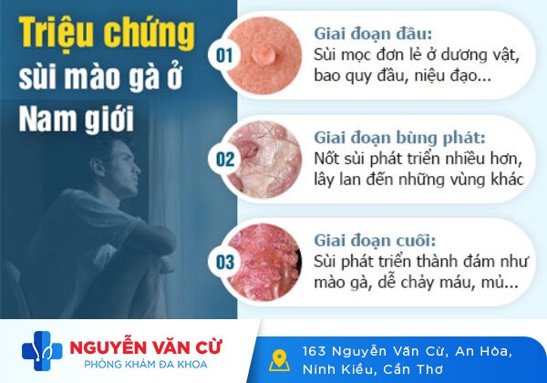 Mọc mụn quanh bao quy đầu