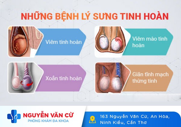 4 Nguyên Nhân Khiến Nam Giới Bị Sưng Tinh Hoàn Một Bên